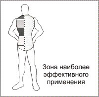 Зона применения электрошокера АВАТАР